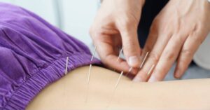 Dry needling tretman u Studio D Zagreb